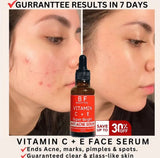ANTI ACNE & GLOWING SERUM VITAMIN C + E
