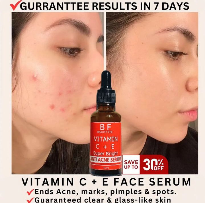ANTI ACNE & GLOWING SERUM VITAMIN C + E