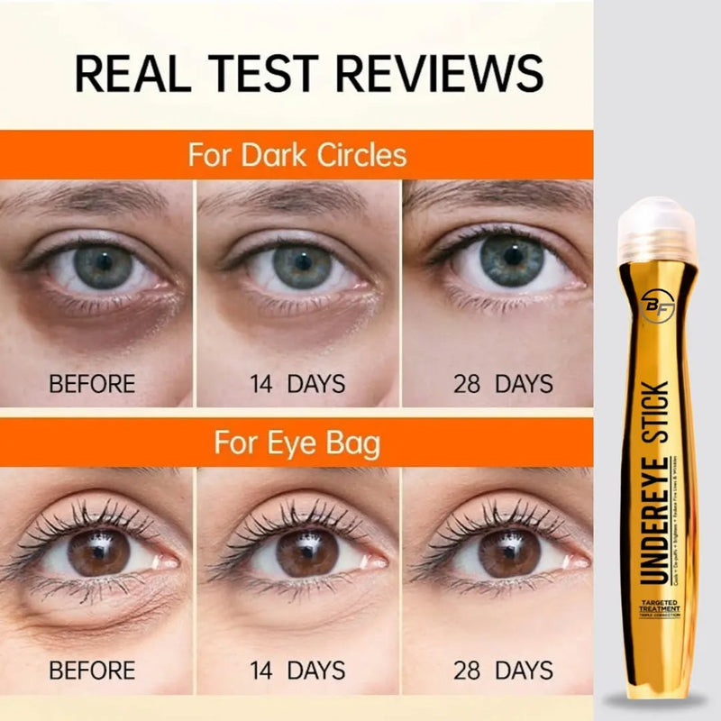 ANTI DARK CIRCLE SERUM